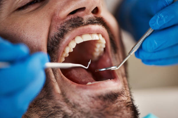 Best Dental Abscess Treatment in Chenoa, IL